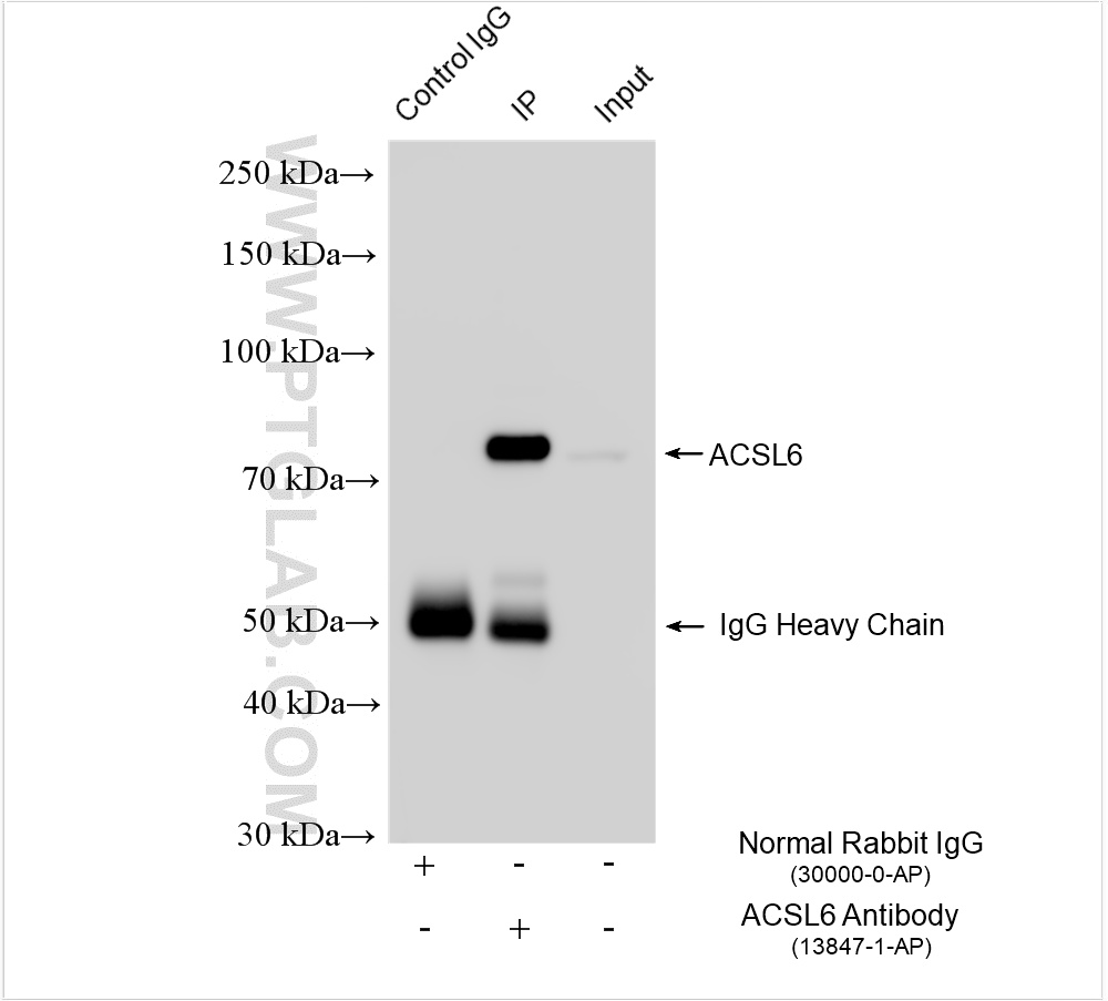 IP experiment of mouse brain using 13847-1-AP