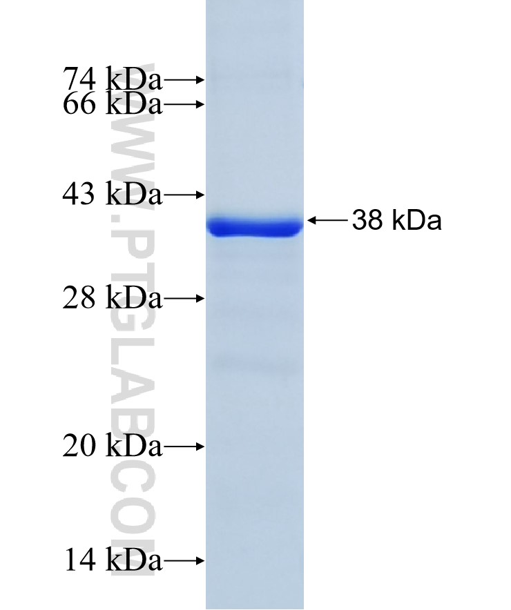 ACSL6 fusion protein Ag5002 SDS-PAGE