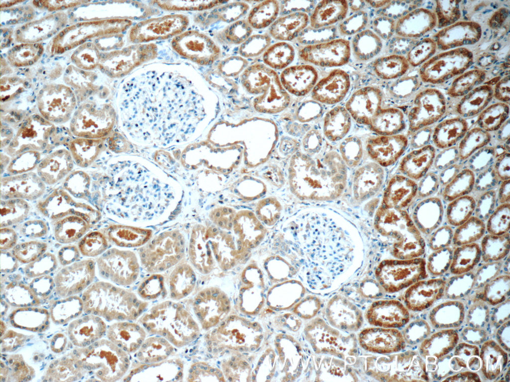 IHC staining of human kidney using 10168-2-AP