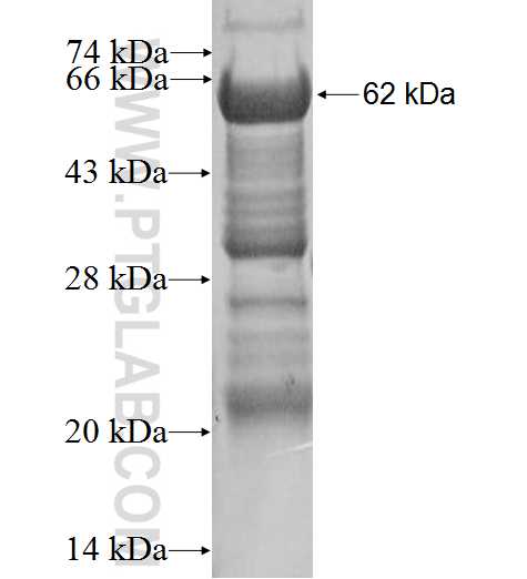 ACSM3 fusion protein Ag0224 SDS-PAGE