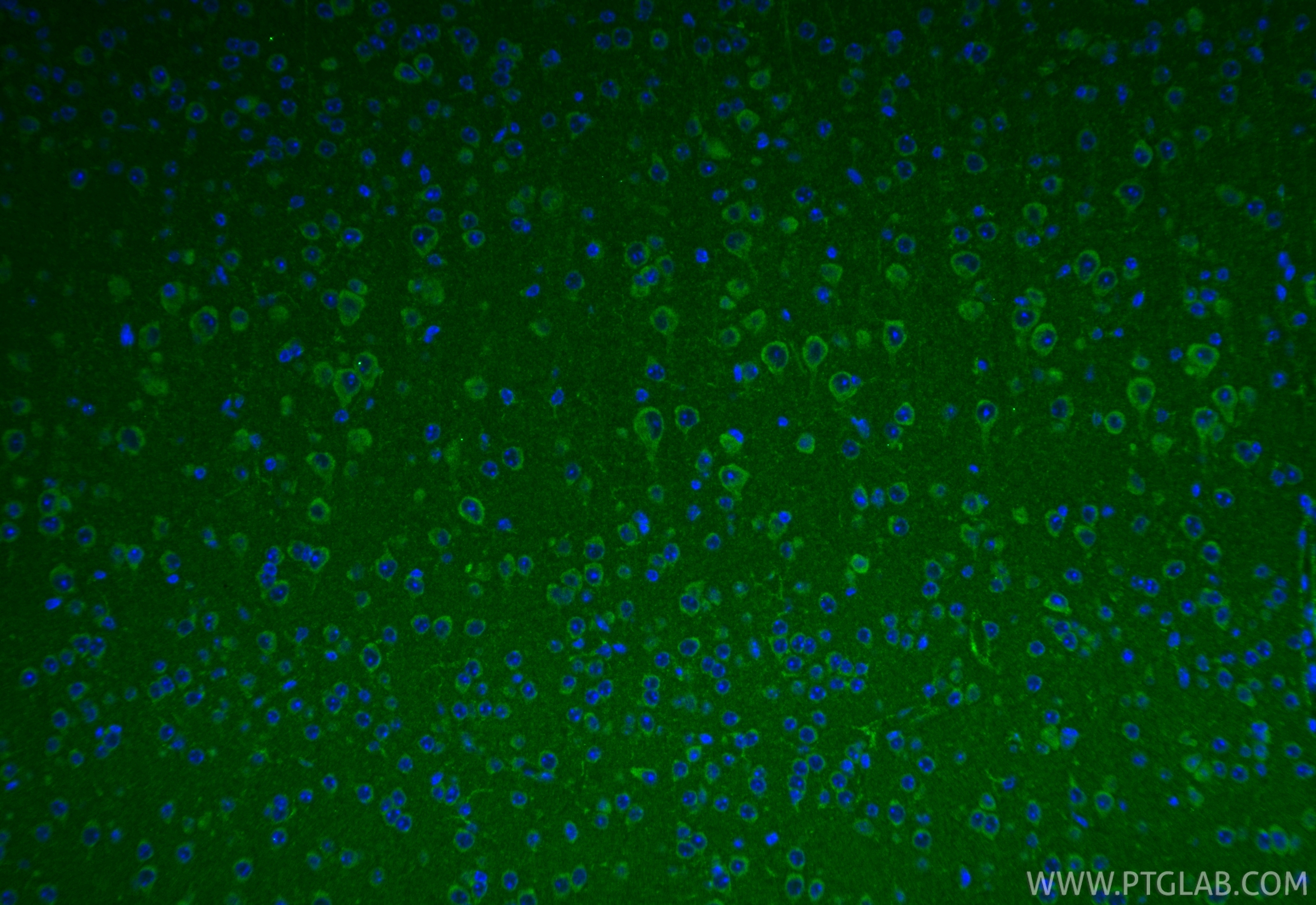 IF Staining of mouse brain using 16591-1-AP