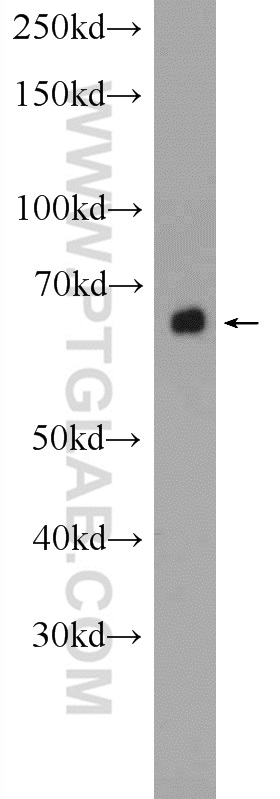 ACSM5
