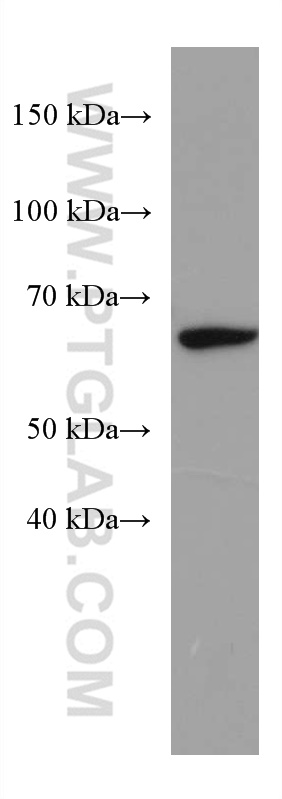 WB analysis of rat liver using 67334-1-Ig (same clone as 67334-1-PBS)