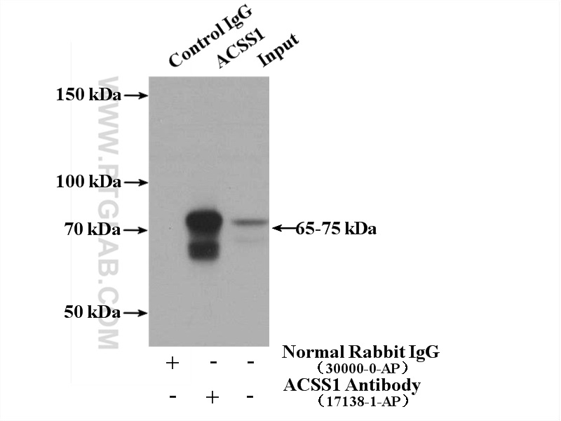 IP experiment of mouse kidney using 17138-1-AP