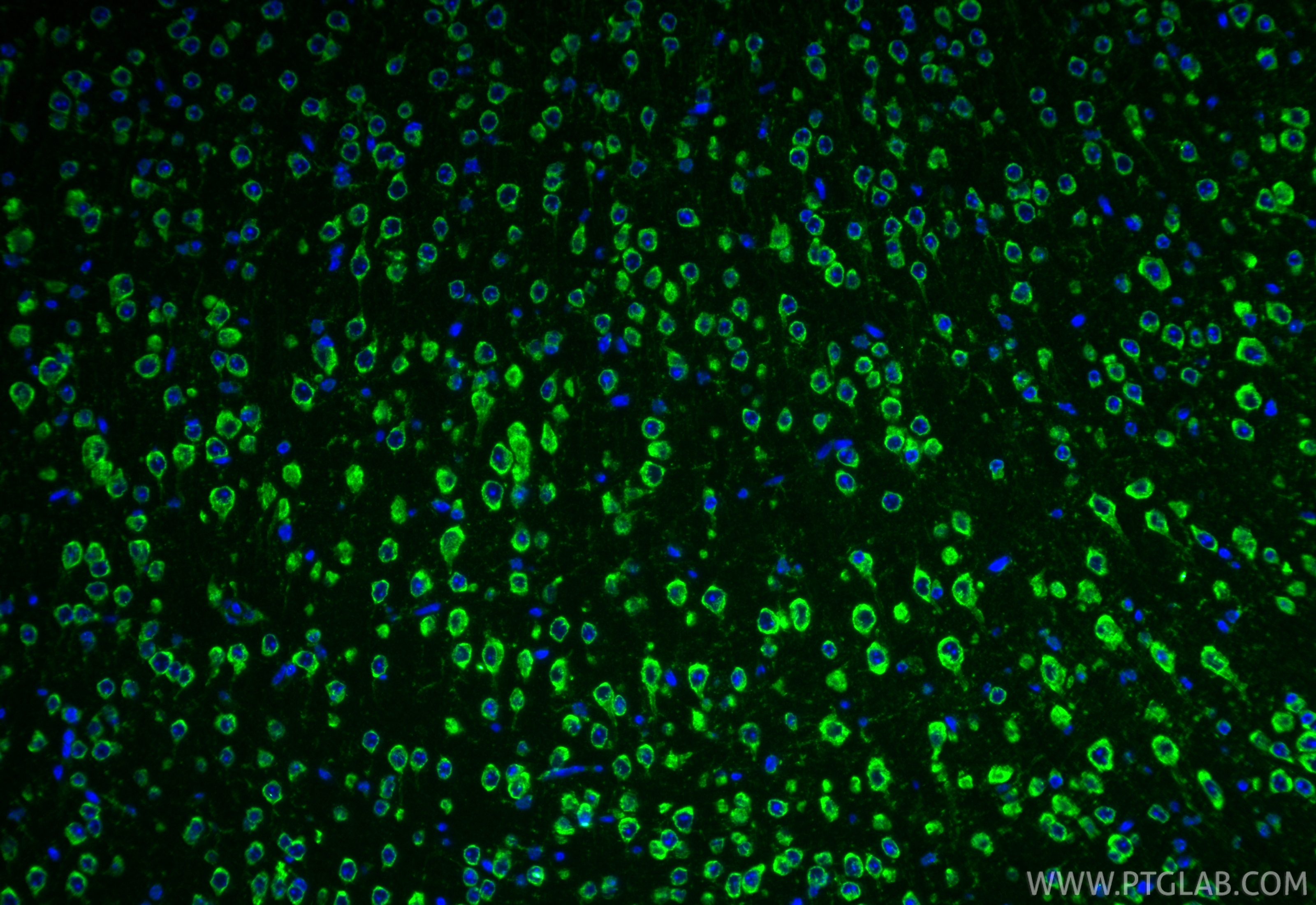 IF Staining of mouse brain using 68608-1-Ig IF Staining of mouse brain using 68608-1-Ig