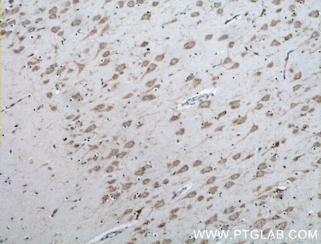 IHC staining of human brain using 16087-1-AP (same clone as 16087-1-PBS)