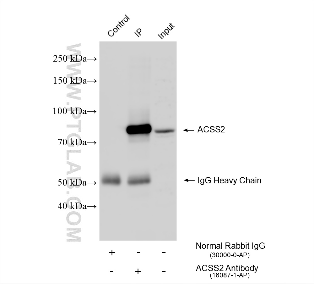 IP experiment of HepG2 using 16087-1-AP (same clone as 16087-1-PBS)