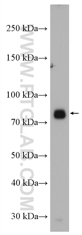 Acetyl CoA synthetase