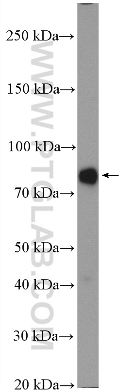 WB analysis of mouse liver using 16087-1-AP