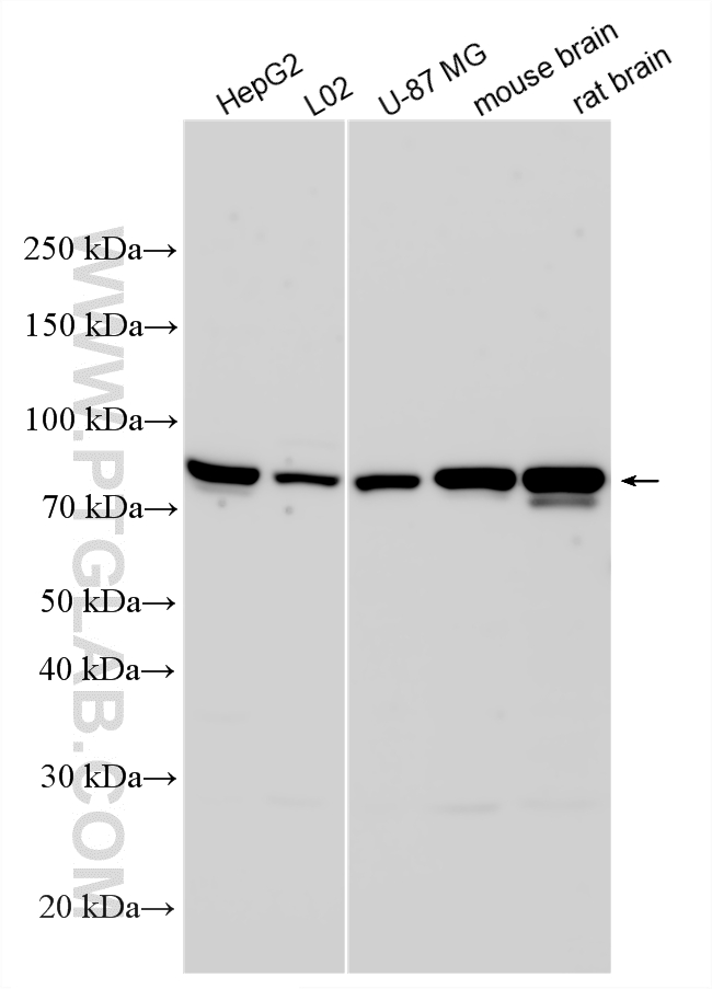 Various lysates were subjected to SDS PAGE followed by western blot with 16087-1-AP (ACSS2 antibody) at dilution of 1:10000 incubated at room temperature for 1.5 hours. WB analysis using 16087-1-AP