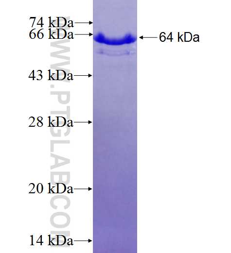 ACSS2 fusion protein Ag9121 SDS-PAGE