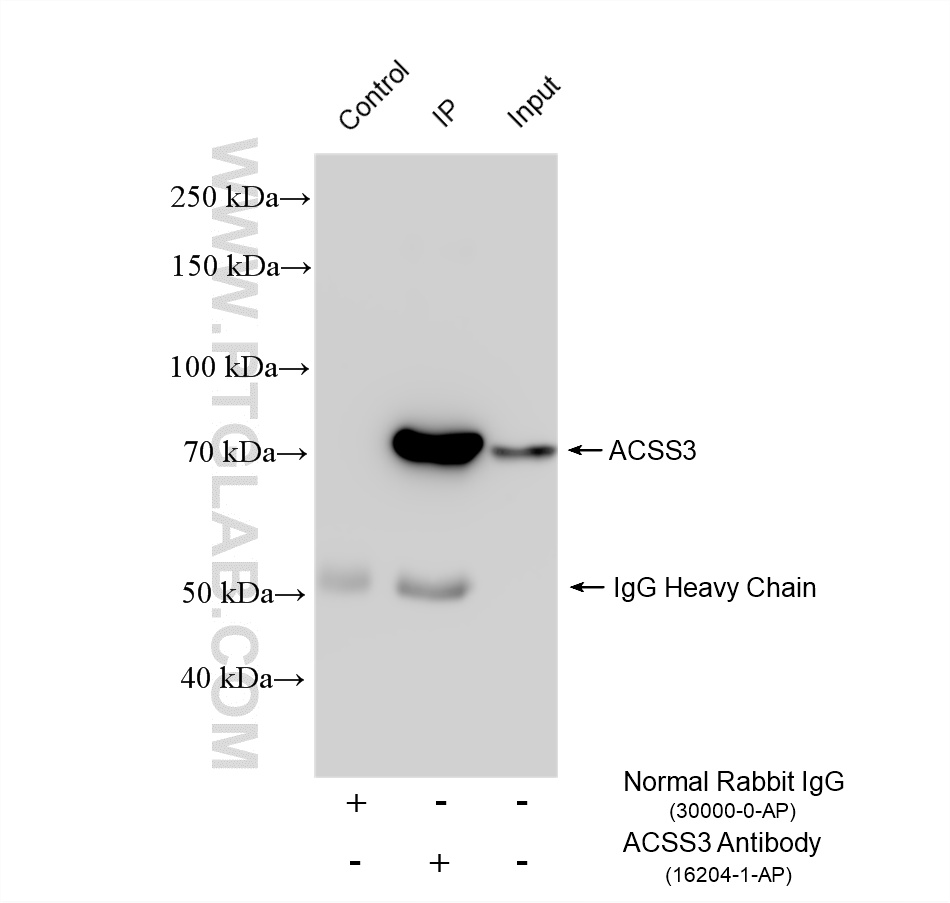 IP experiment of mouse liver using 16204-1-AP