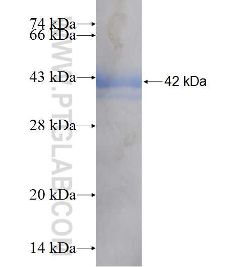 ACSS3 fusion protein Ag9164 SDS-PAGE