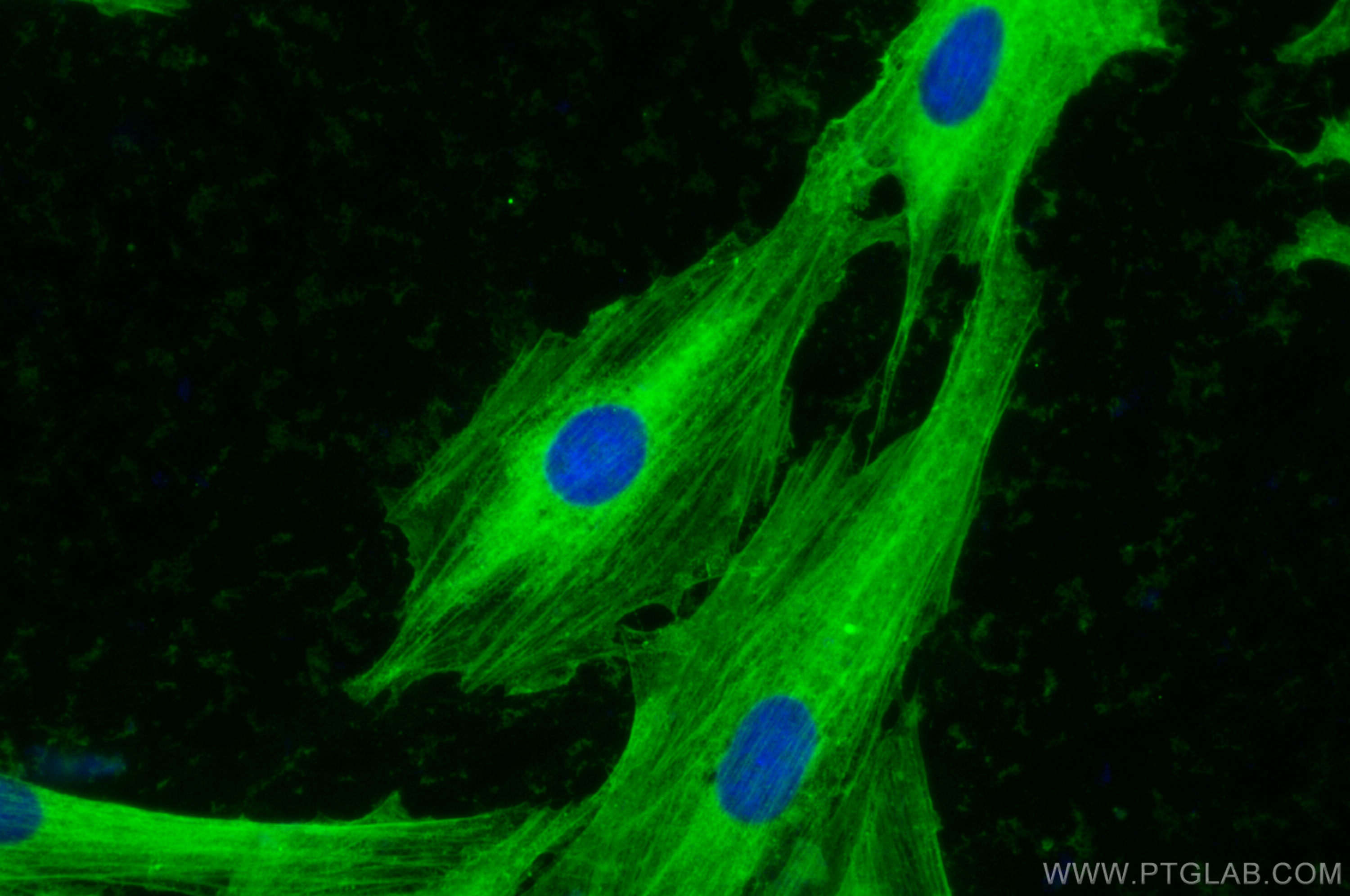 IF Staining of H9C2 using 23660-1-AP