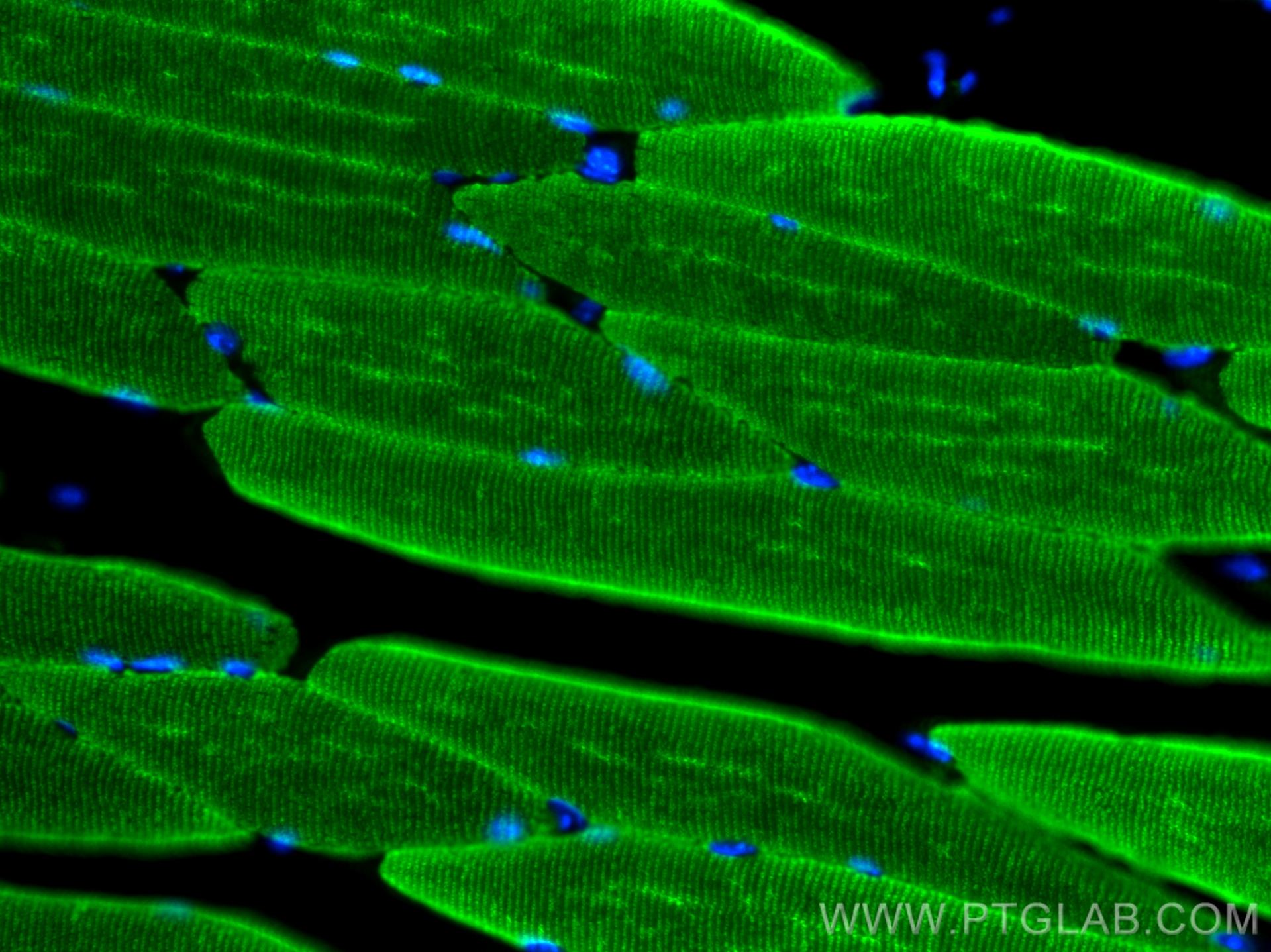 IF Staining of mouse skeletal muscle using 23660-1-AP