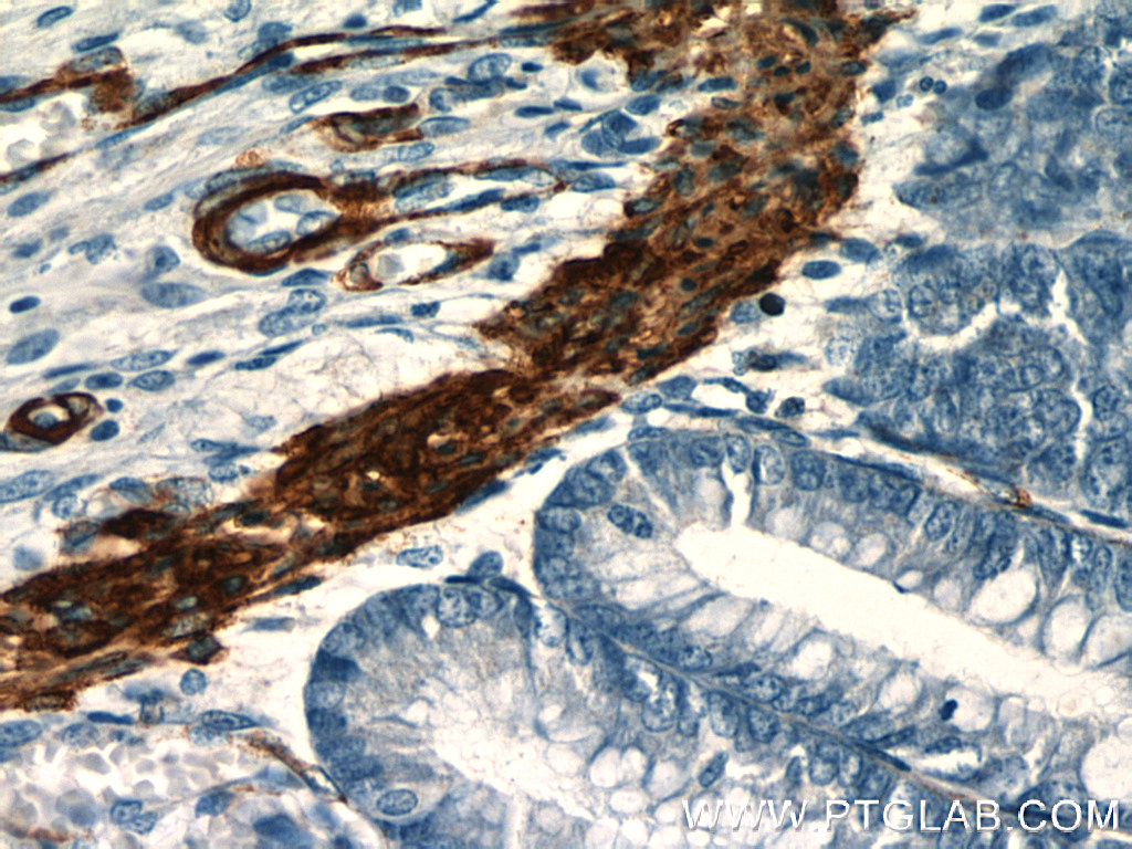 IHC staining of human colon using 23660-1-AP