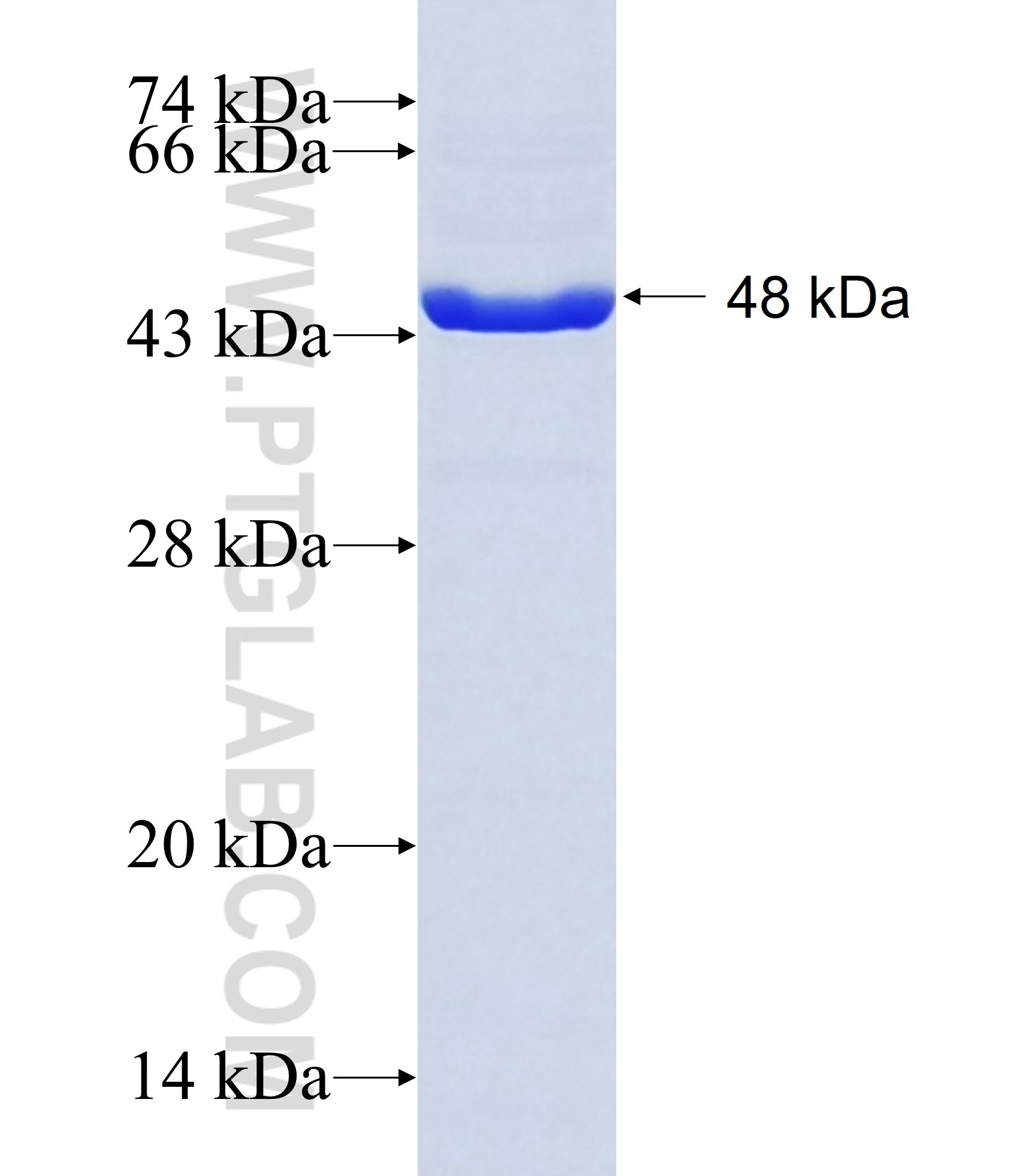 ACTA1 fusion protein Ag20271 SDS-PAGE