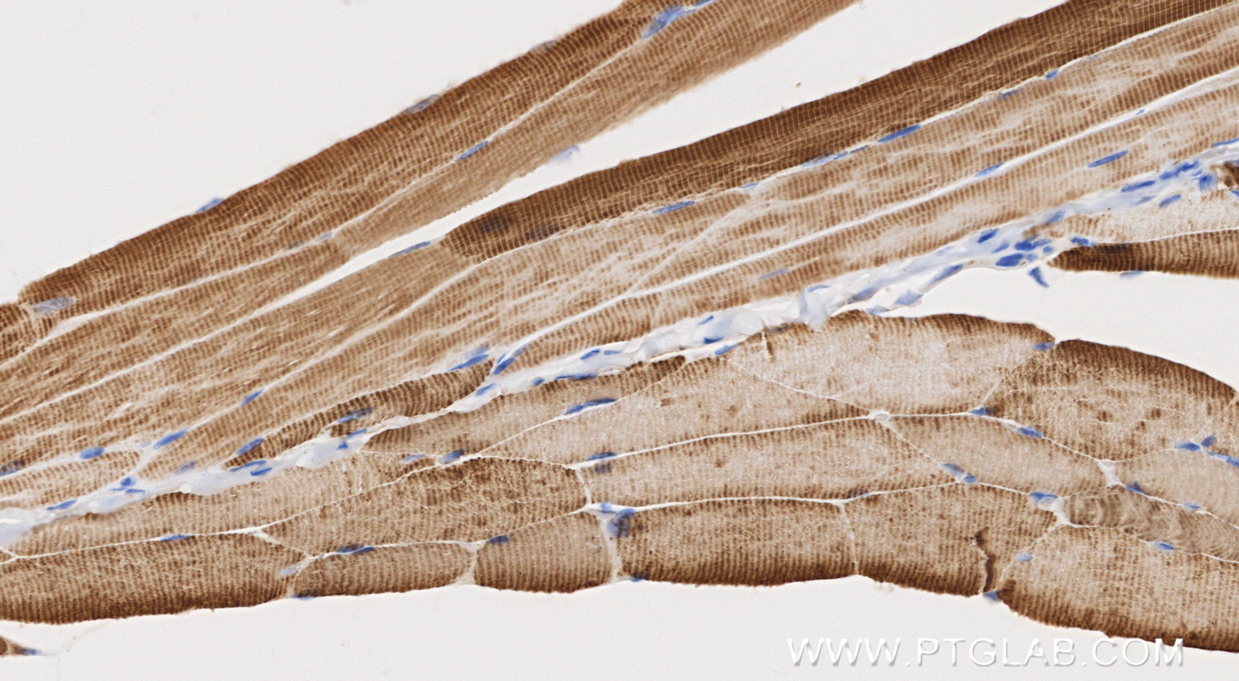 Immunohistochemical analysis of paraffin-embedded mouse skeletal muscle tissue slide using <a class='green' href='/productredirect?CatalogNo=82714-5-RR' target='_blank'>82714-5-RR</a> (ACTA1-Specific antibody) at dilution of 1:1000 (under 40x lens). Heat mediated antigen retrieval with Tris-EDTA buffer (pH 9.0). This data was developed using the same antibody clone with 82714-5-PBS in a different storage buffer formulation. IHC staining of mouse skeletal muscle using 82714-5-RR (same clone as 82714-5-PBS)
