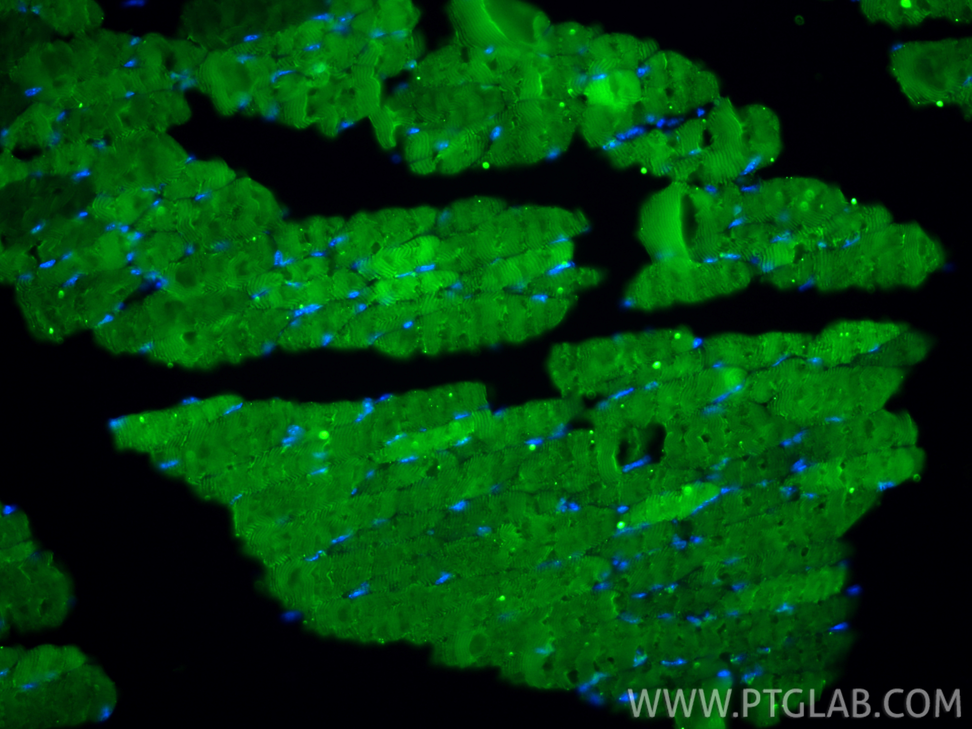 IF Staining of mouse skeletal muscle using CL488-82714-5