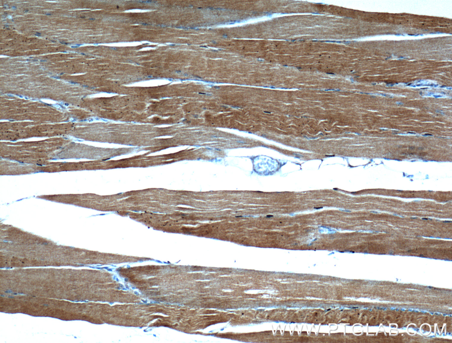 IHC staining of human skeletal muscle using 17521-1-AP