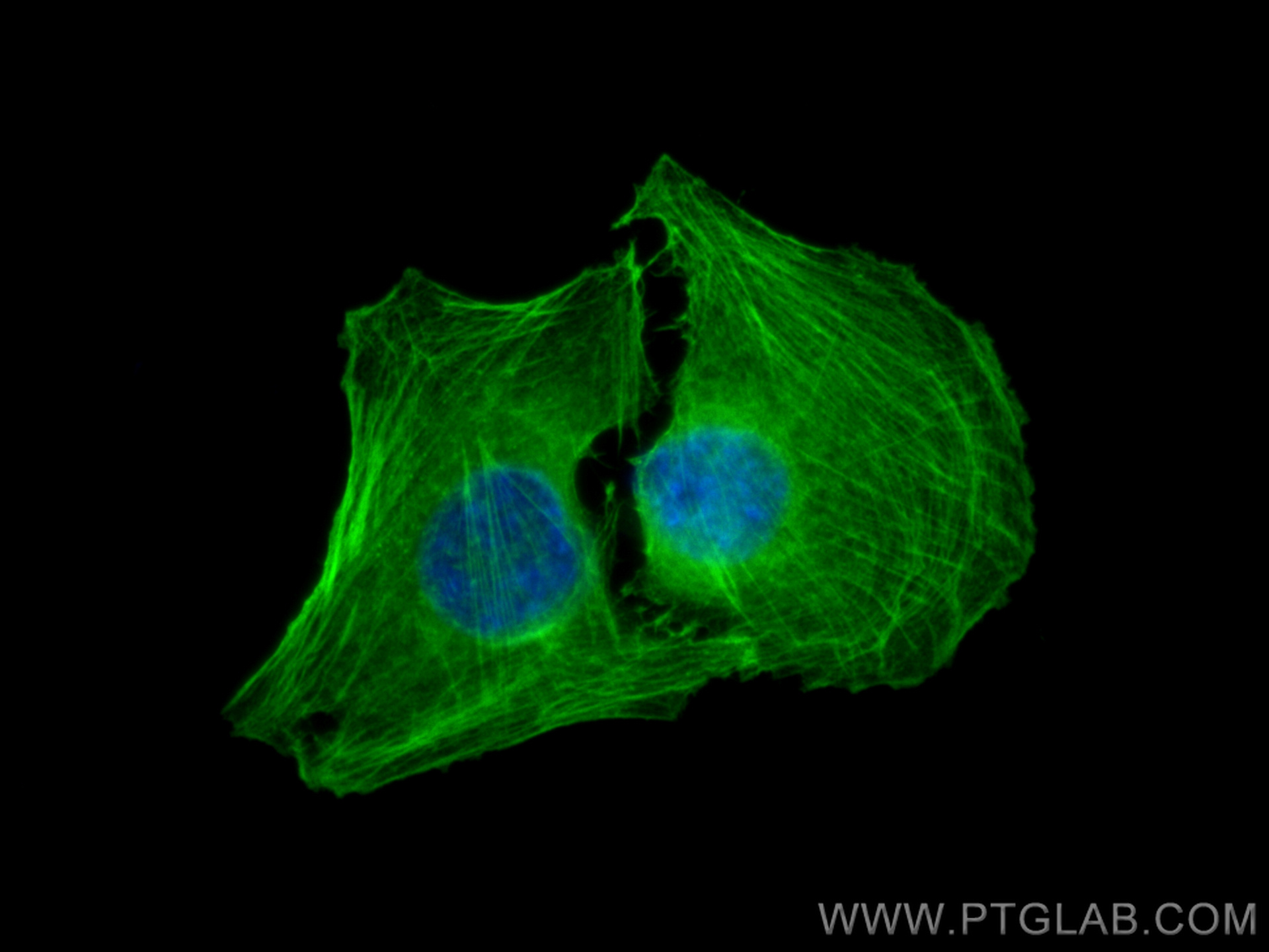 IF Staining of C2C12 using 14395-1-AP