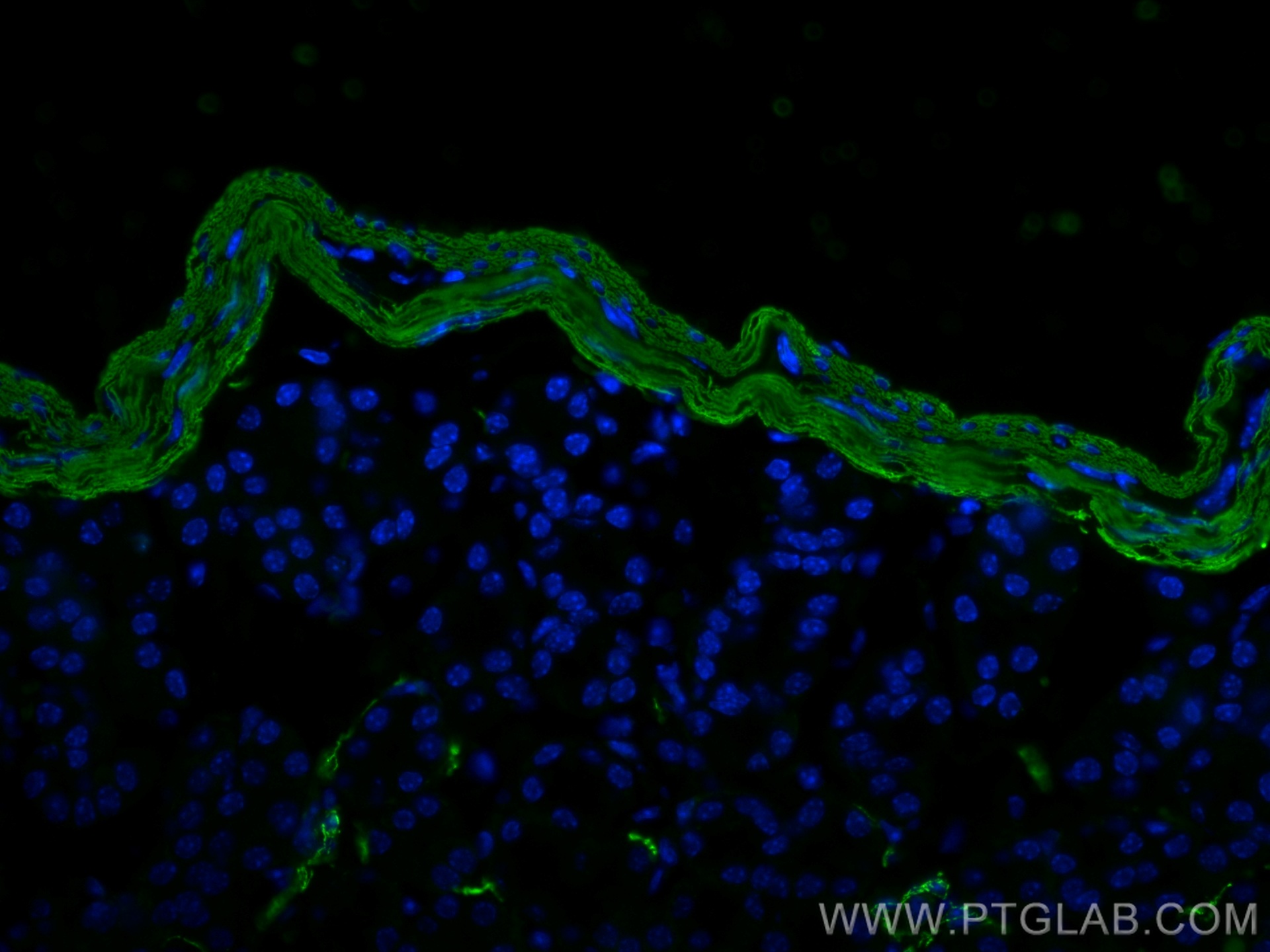 IF Staining of mouse small intestine using 14395-1-AP