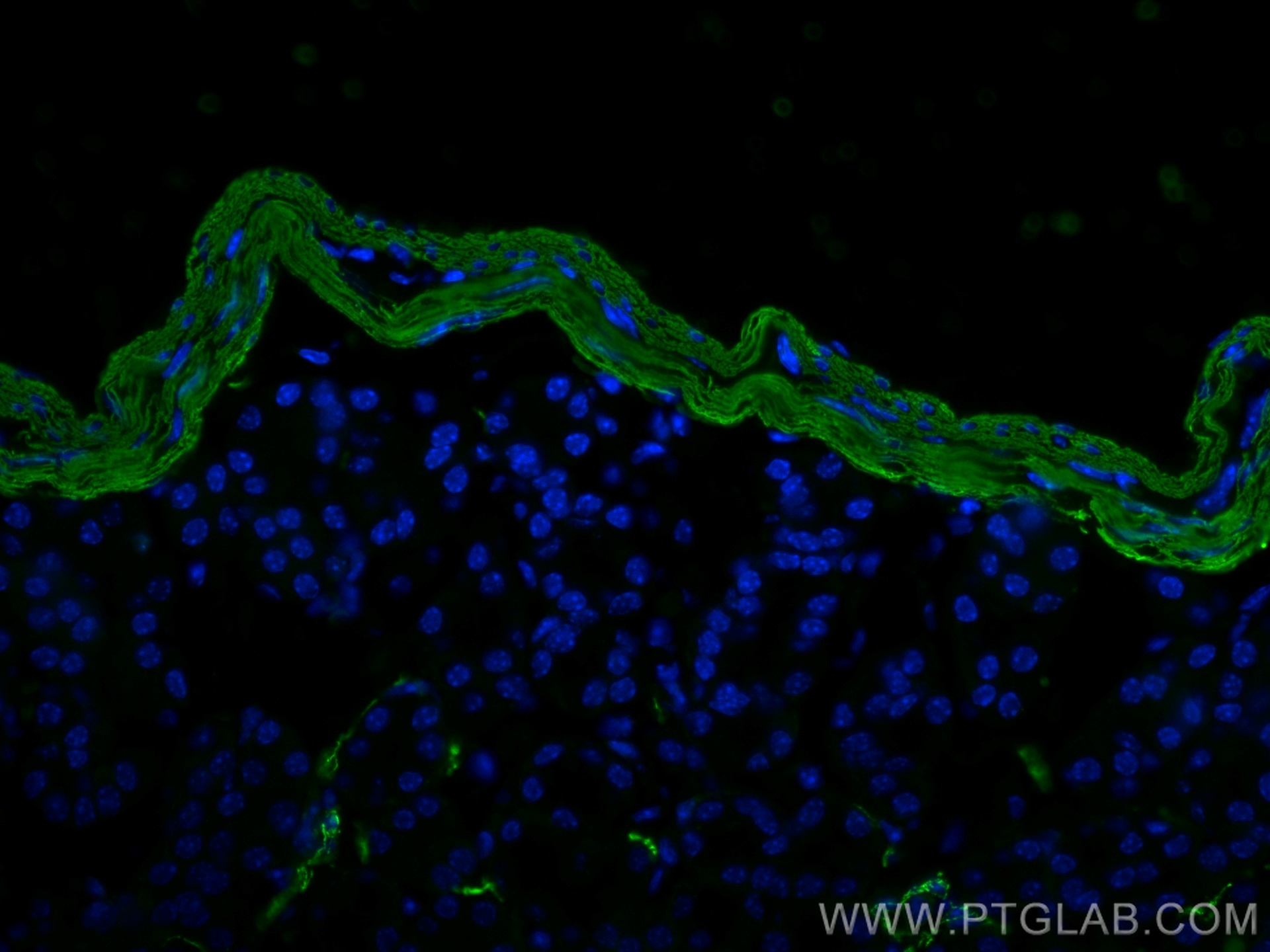 IF Staining of mouse small intestine using 14395-1-AP