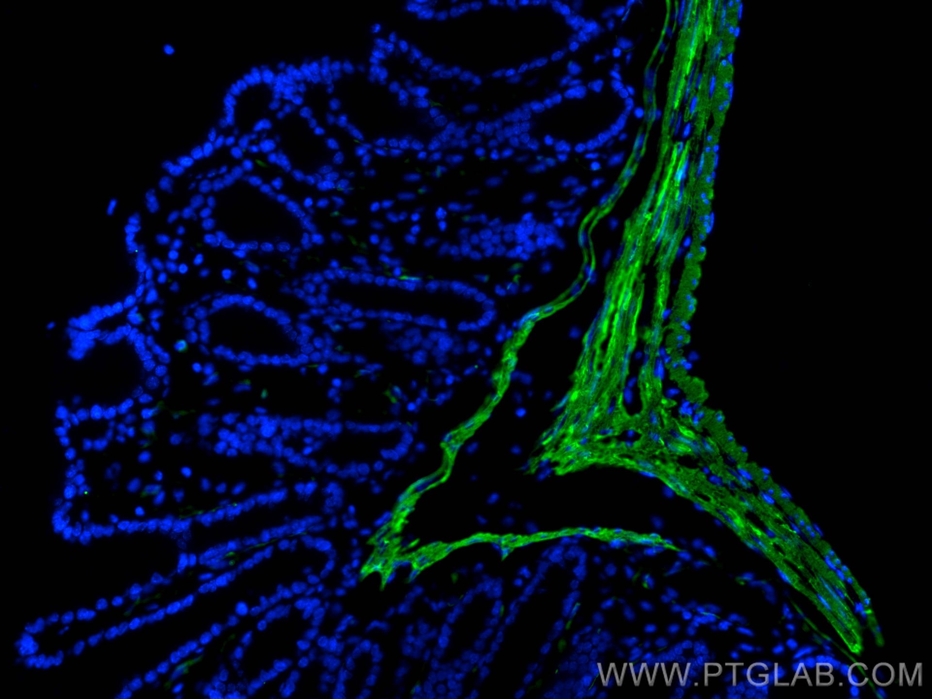 IF Staining of mouse colon using 14395-1-AP