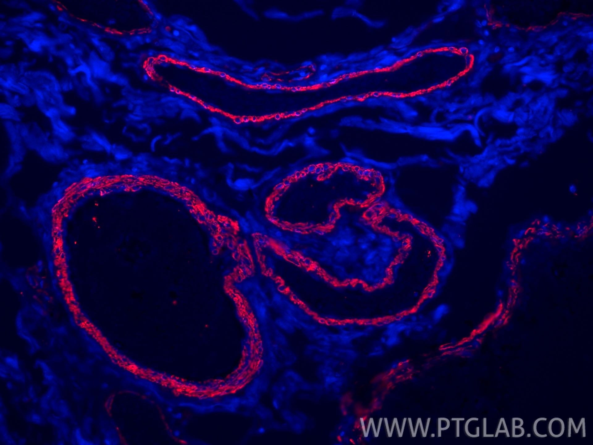 IF Staining of human colon using 14395-1-AP