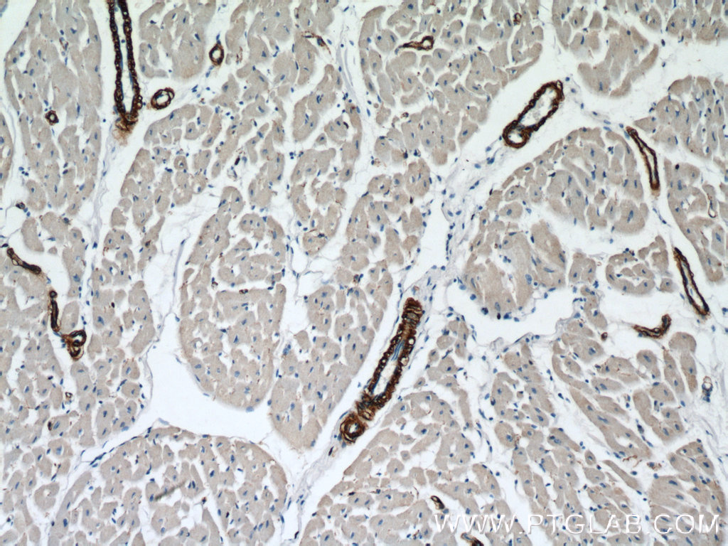 IHC staining of human heart using 14395-1-AP