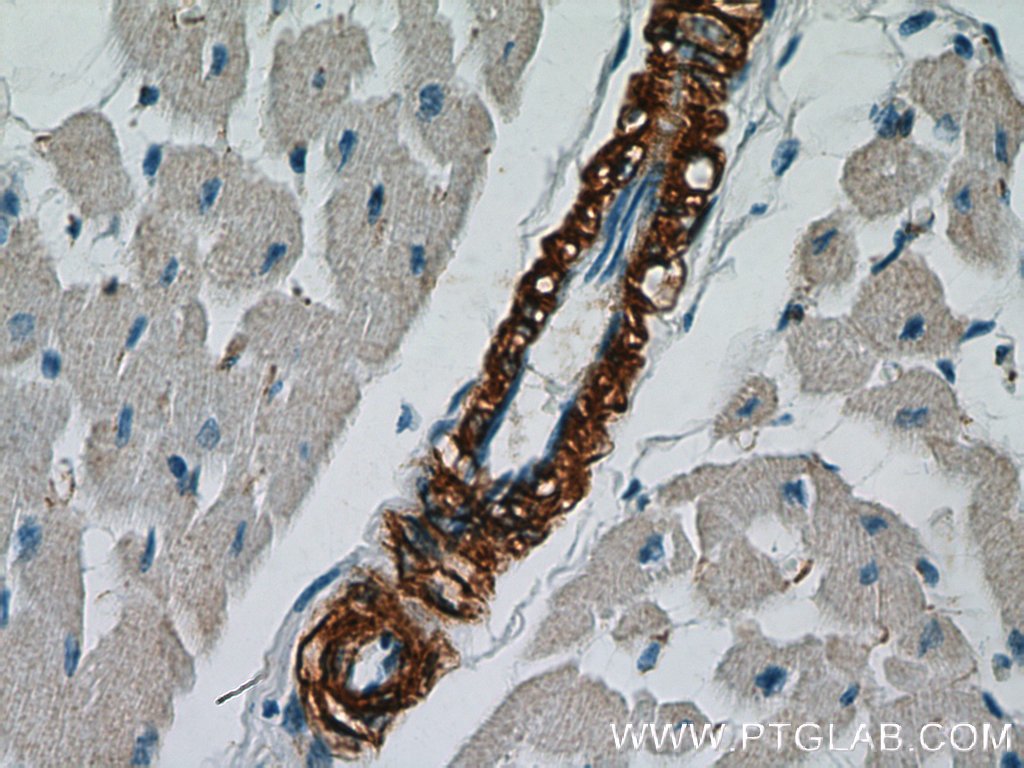 smooth muscle actin Polyclonal antibody