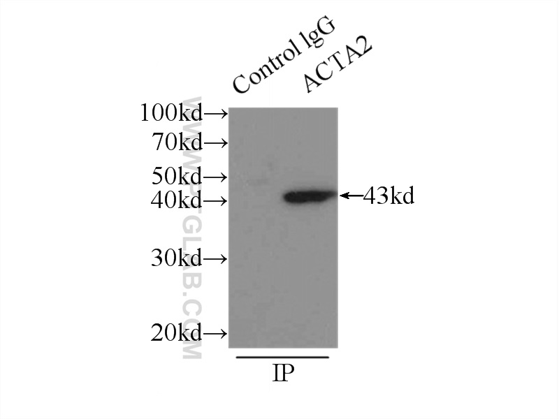 IP experiment of mouse liver using 14395-1-AP