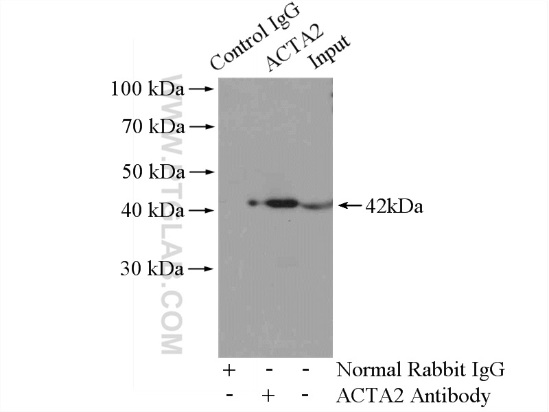 IP experiment of mouse heart using 23081-1-AP