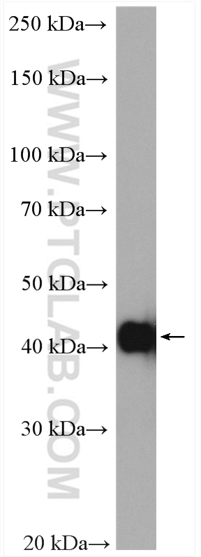 WB analysis of mouse heart using 23081-1-AP