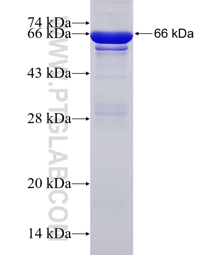 ACTA2 fusion protein Ag5886 SDS-PAGE