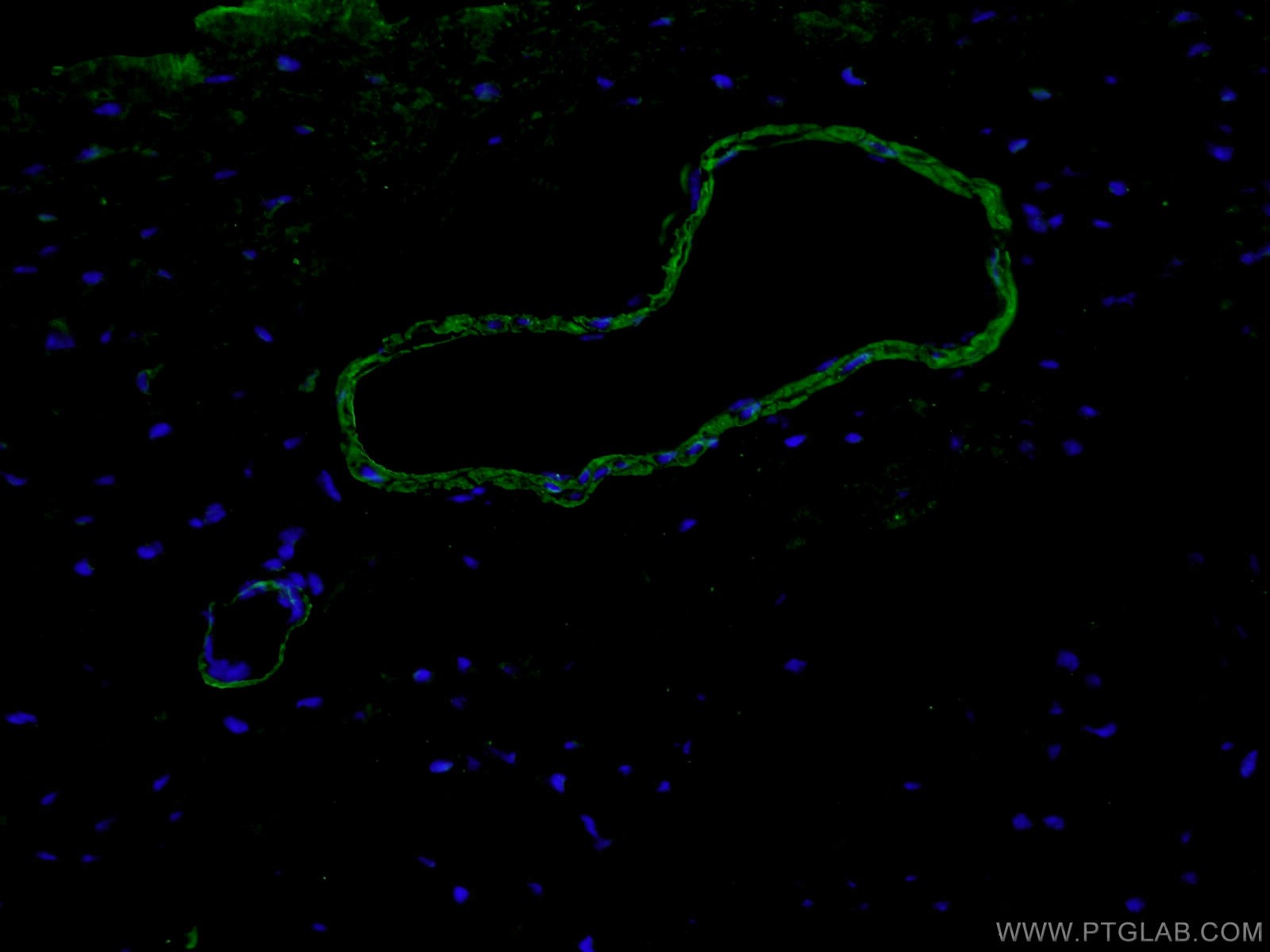 IF Staining of mouse heart using 55135-1-AP