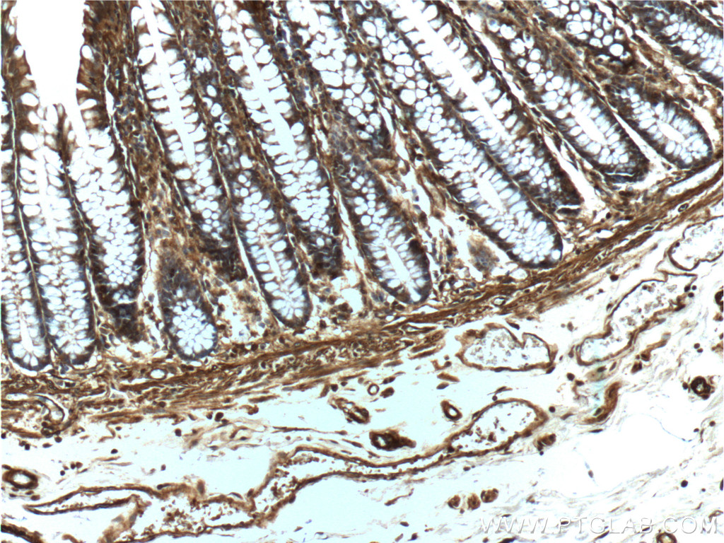 IHC staining of human colon using 20536-1-AP
