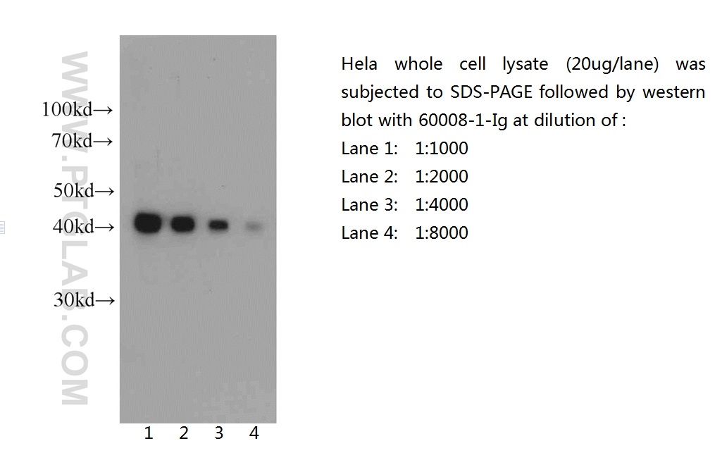 Beta Actin Monoclonal antibody