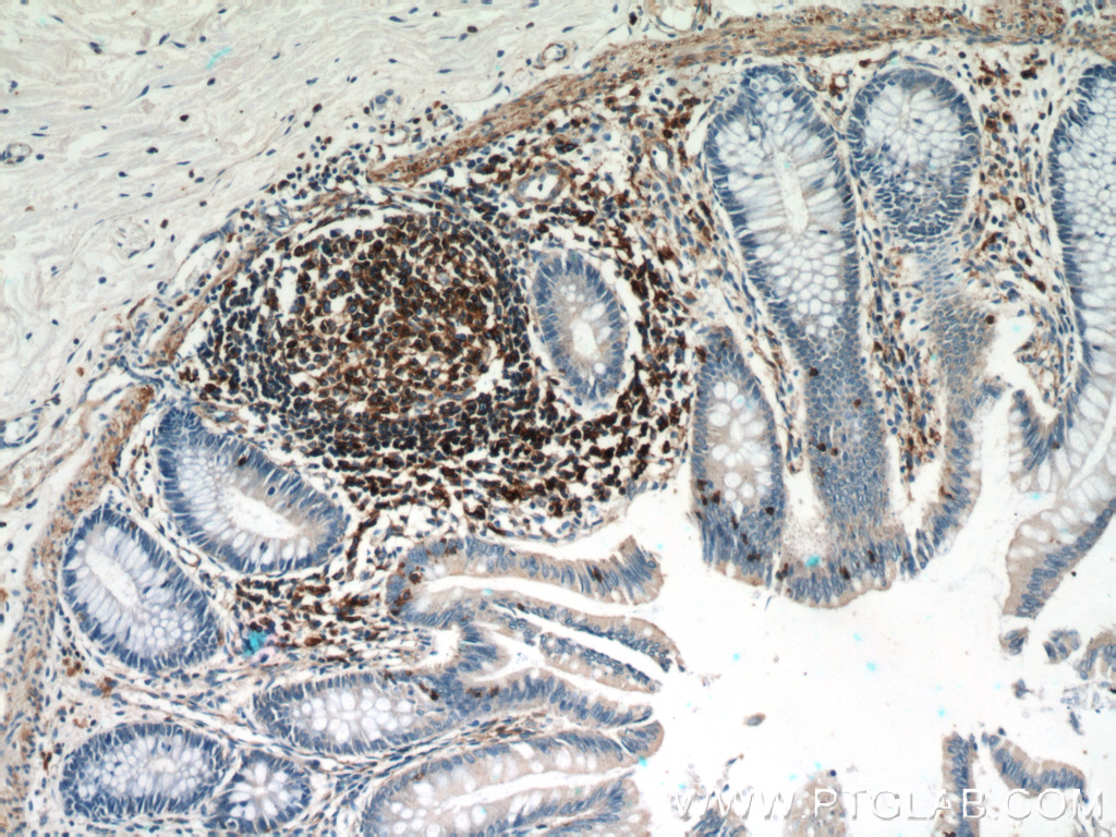 IHC staining of human colon using 60008-1-Ig