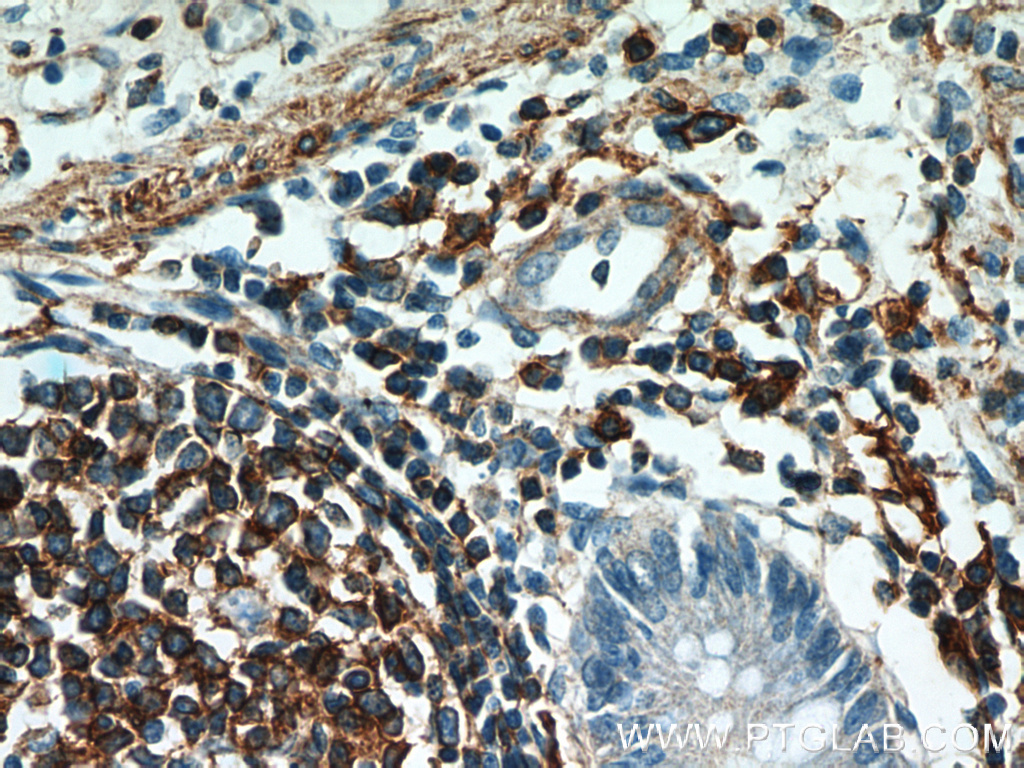 IHC staining of human colon using 60008-1-Ig