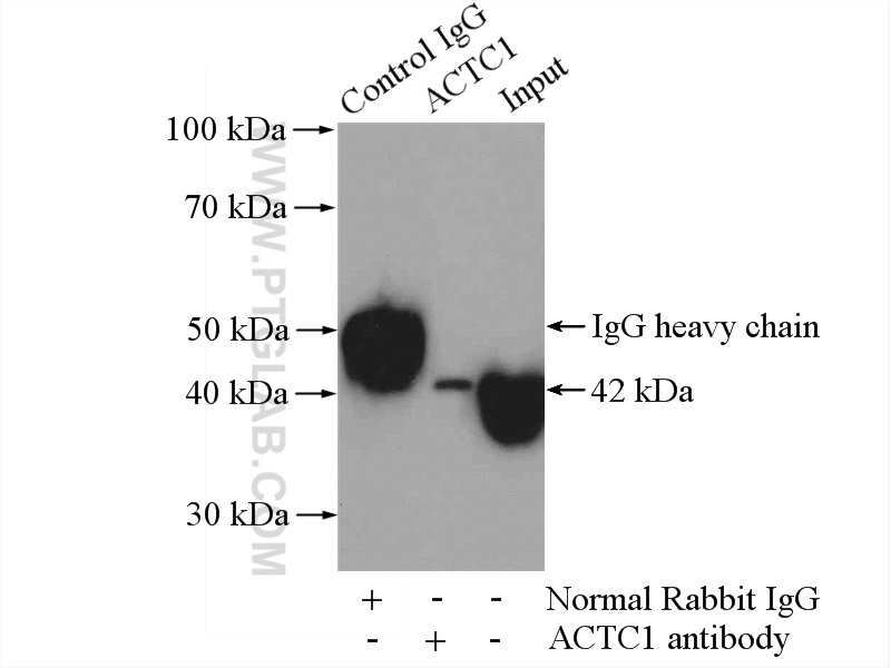 IP experiment of mouse heart using 11032-1-AP