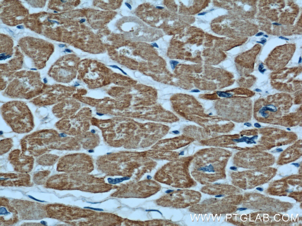 IHC staining of human heart using 23082-1-AP