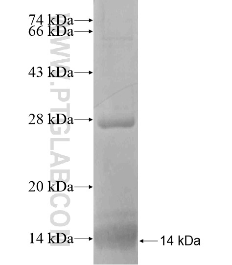 ACTC1 fusion protein Ag19477 SDS-PAGE ACTC1 fusion protein Ag19477 SDS-PAGE