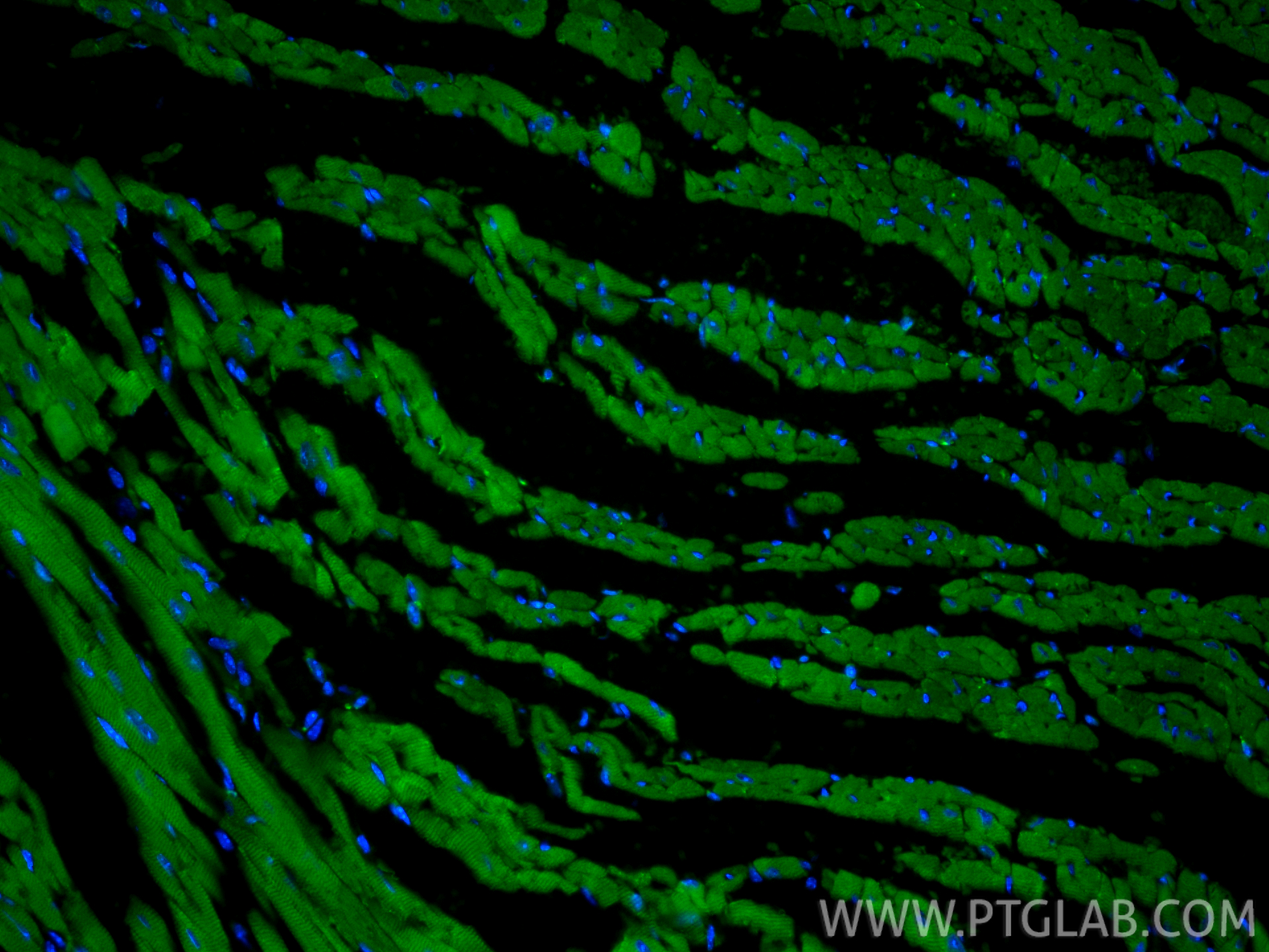 IF Staining of mouse heart using CL488-66125