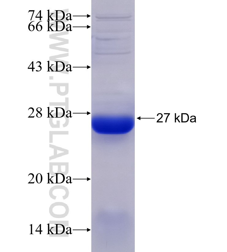 ACTG1 Fusion Protein Ag31029 | Proteintech | 武汉三鹰生物技术有限公司