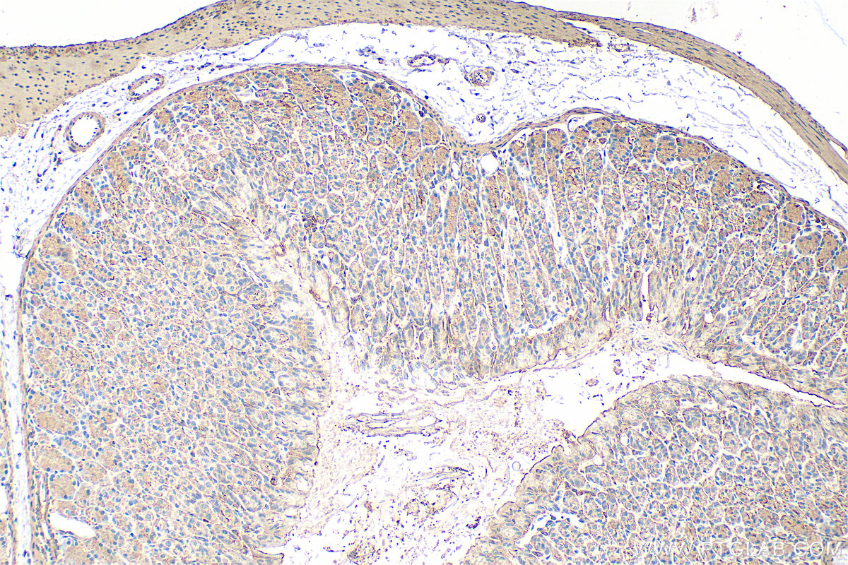 IHC staining of mouse stomach using 31849-1-AP