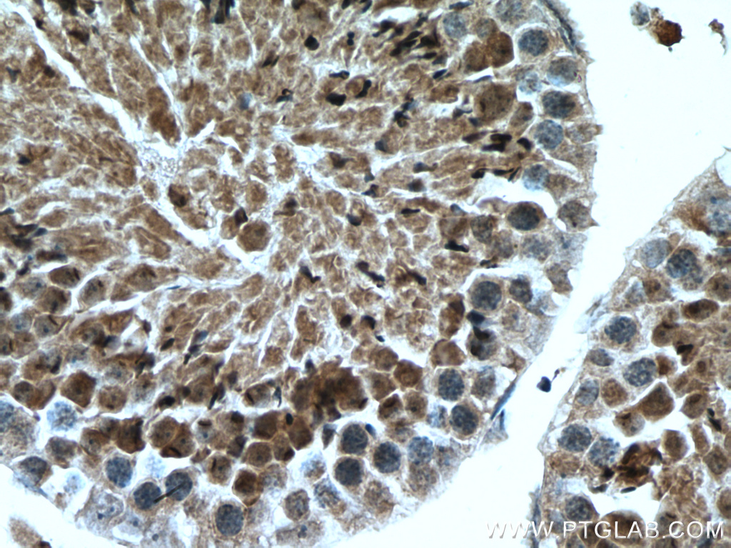 IHC staining of mouse testis using 17355-1-AP