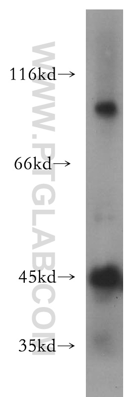 WB analysis of human testis using 13537-1-AP