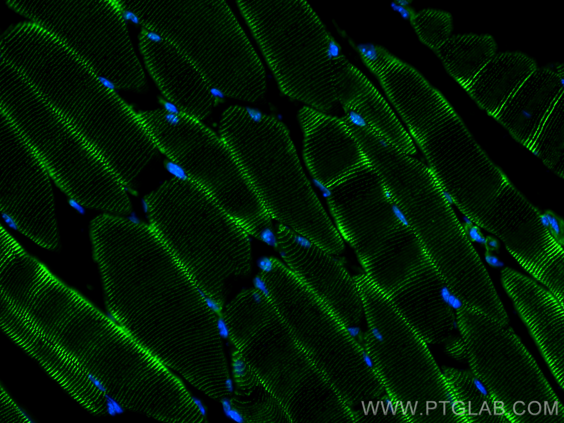 IF Staining of mouse skeletal muscle using 11313-2-AP
