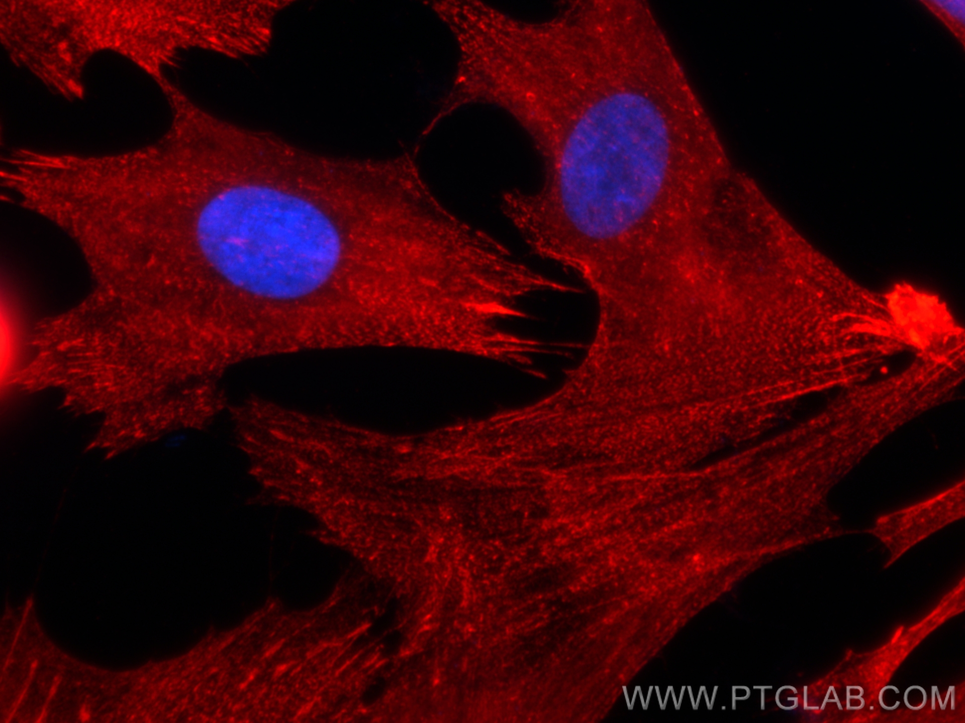 IF Staining of HSkMC using 11313-2-AP